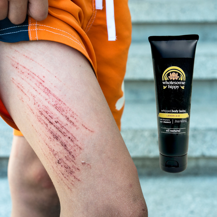 Lemon Aid Whipped Wonder Body Balm with Limonene 2oz