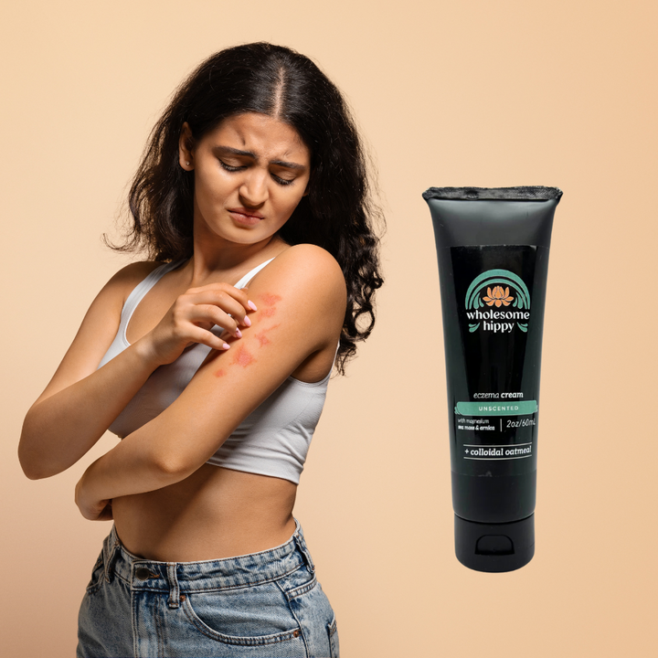 Eczema Rescue Herbal Creme 2oz